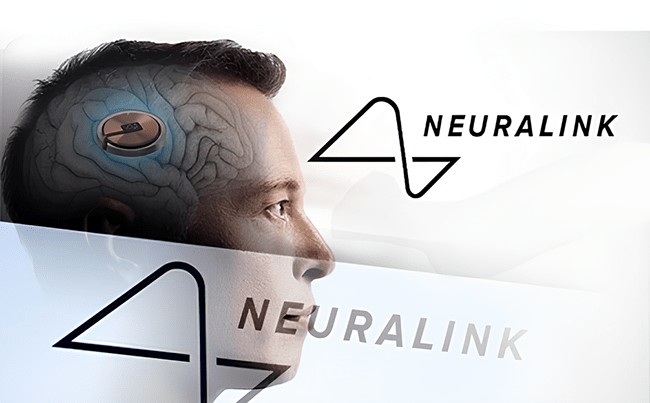 Neuralink chip implanted in human body for first t